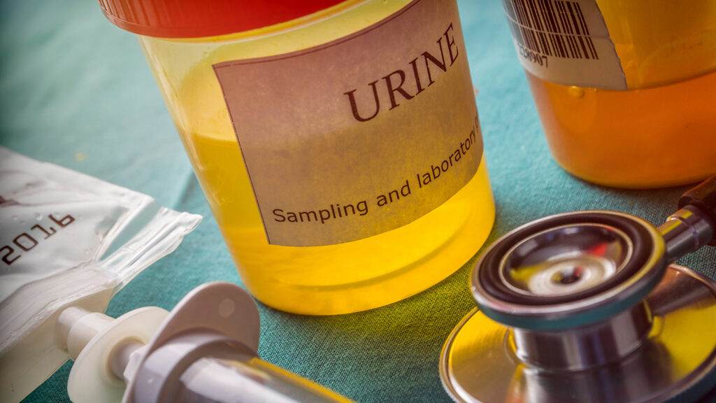 Negative test results are usually provided quicker because there is no requirement for confirmatory testing.