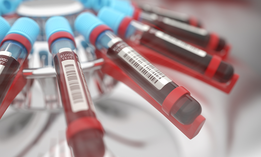 Blood tests are the most accurate method available for determining if drug use has recently occurred.